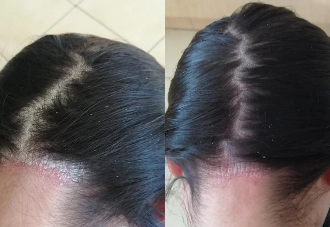 Best Hair Growth Spray Products EZZ OFFICIAL