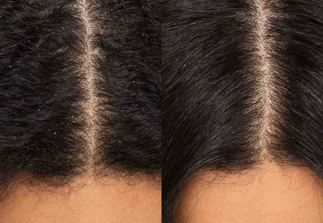 Best Hair Growth Spray Products EZZ OFFICIAL