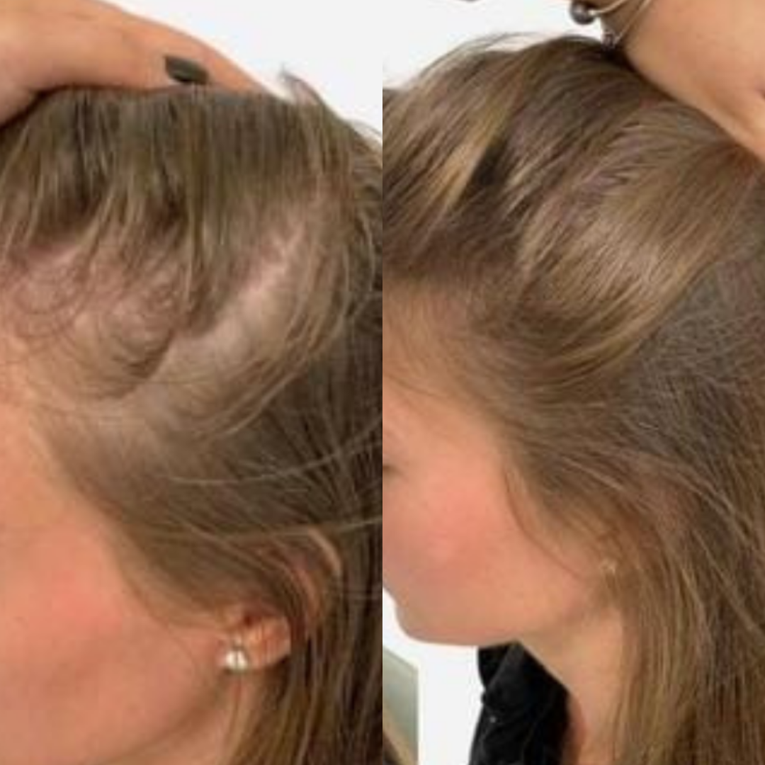 Best Hair Growth Spray Products EZZ OFFICIAL