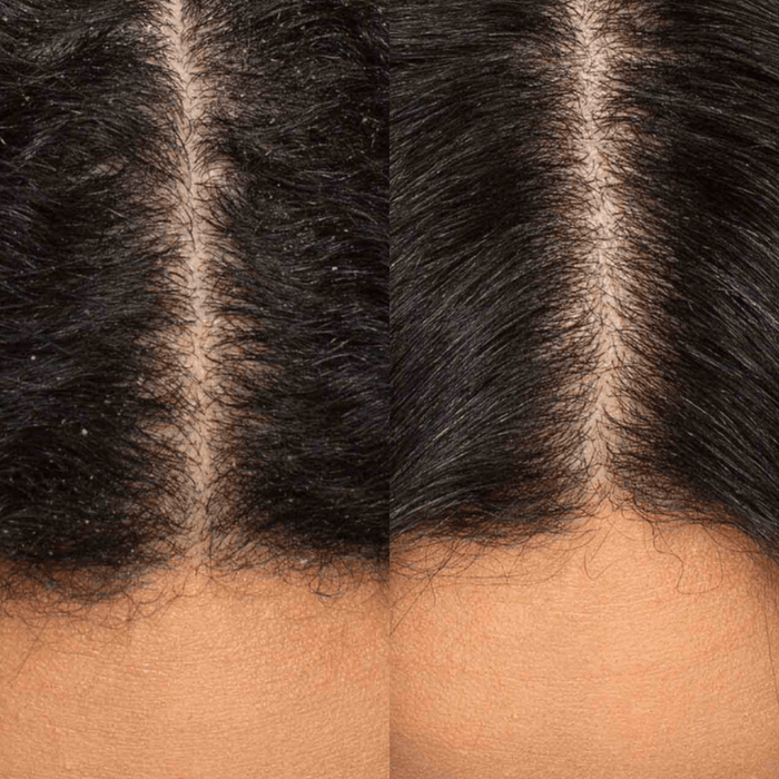 Best Daily Routine for Hair Growth: Simple Habits for a Healthier Scalp - Best Hair Growth Spray Products EZZ OFFICIAL