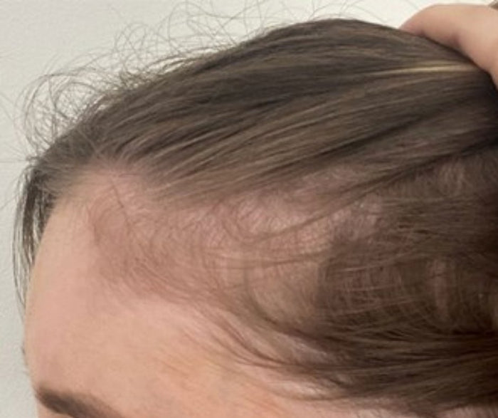 Which hair spray is best for hair growth? - Best Hair Growth Spray Products EZZ OFFICIAL