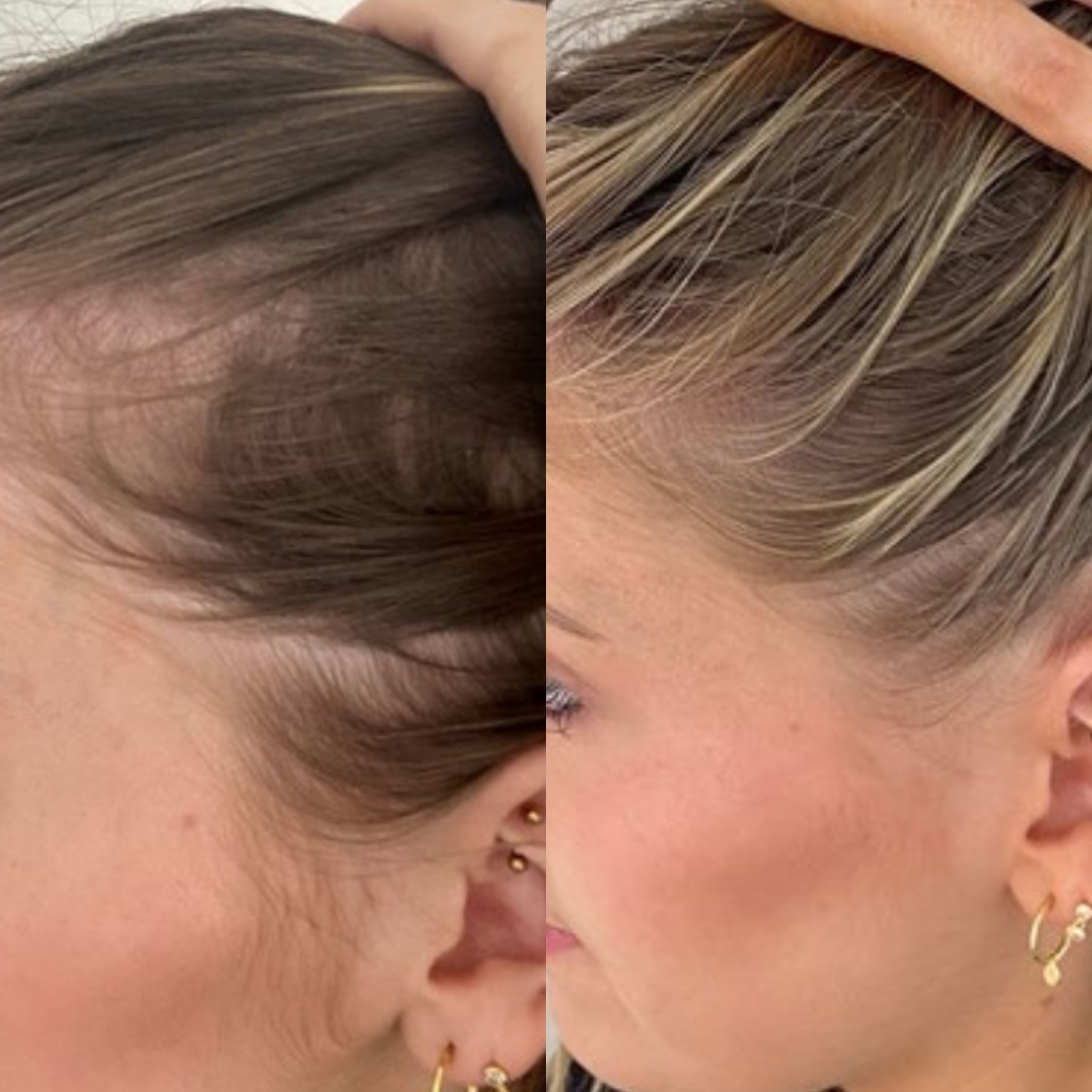 Best Hair Growth Spray Products EZZ OFFICIAL