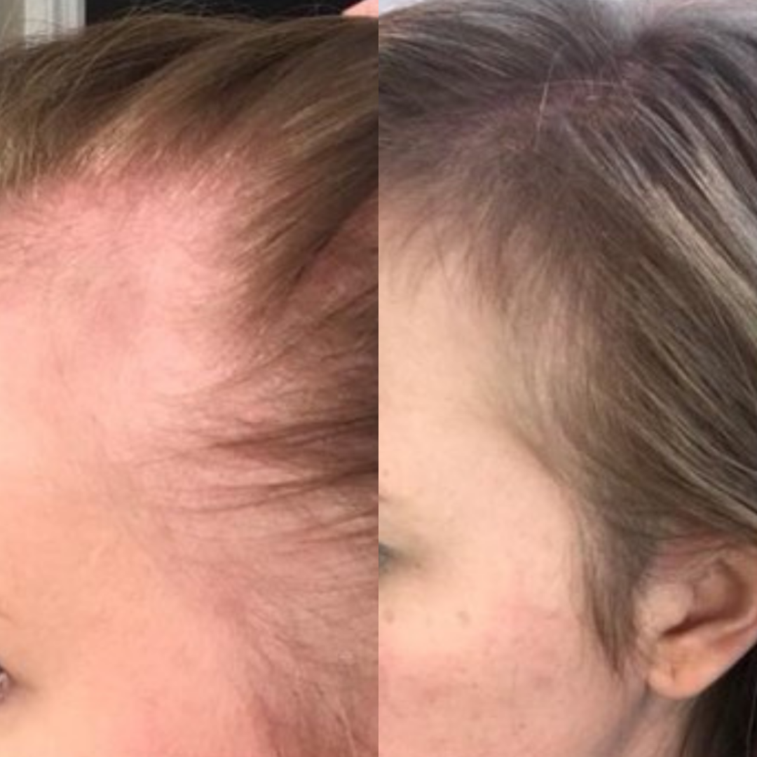 Best Hair Growth Spray Products EZZ OFFICIAL